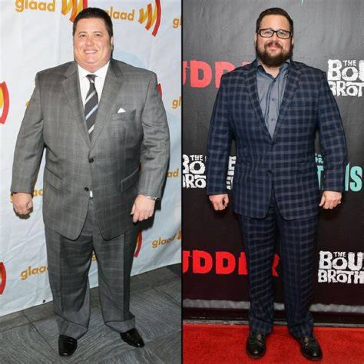 All that Chaz Bono on &lsquo;Dancing,&rsquo; surgery Boston Herald