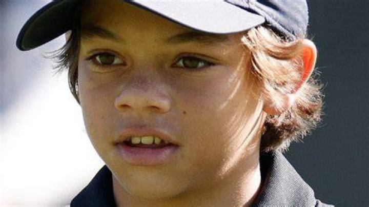 Charlie Woods' Skin Condition And Disappearance
