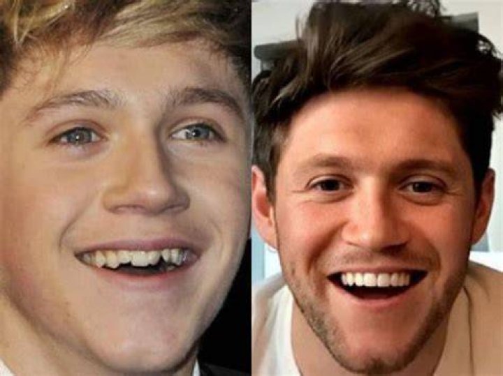 Did He Wear Braces Then And Now