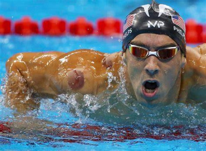 Did Michael Phelps Just Make Cupping a Legitimate Thing? Fortune