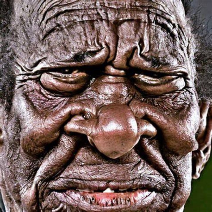 Discoveries About The "Most Ugly Man In The World"