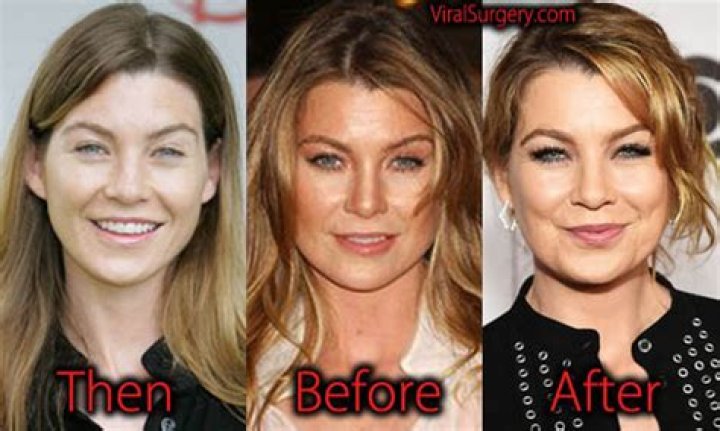 Ellen Pompeo facelift before and after Facelift before and after