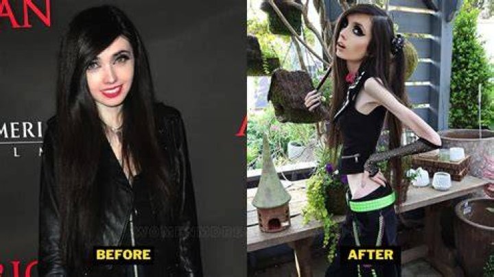 Eugenia Cooney Before And After How Did She Loss Her Weight? Lake