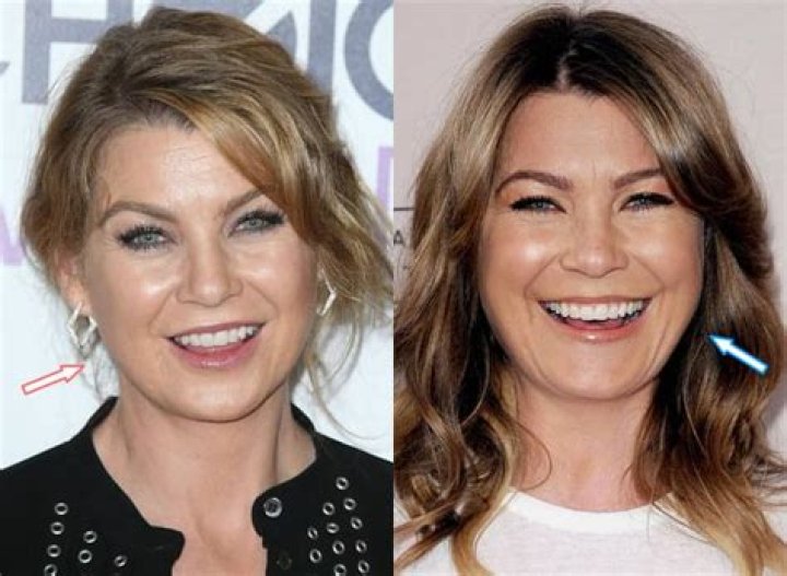 Has Ellen Pompeo Had Cosmetic Surgery? (Before & After Photos)
