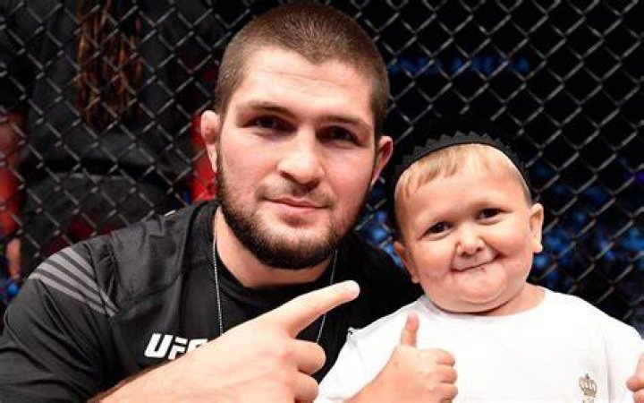 Hasbulla Disability: What Condition Does Mini Khabib Have?