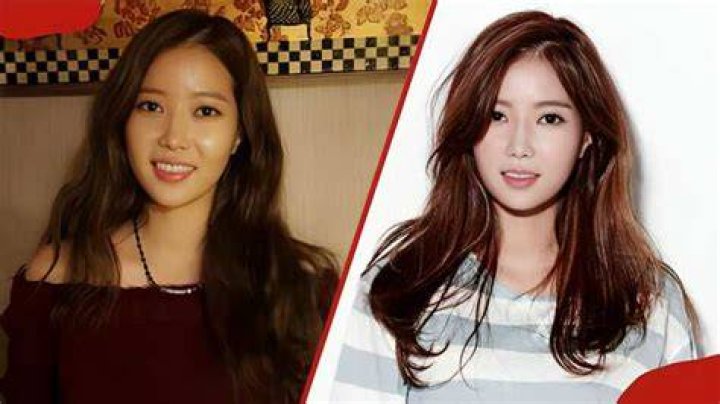 Im Soohyang plastic surgery details, before and after looks Tuko.co.ke