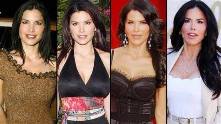 Lauren Sanchez Before and After Plastic Surgery Lips, Facelift, Botox