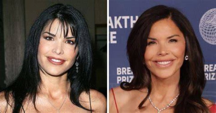 Lauren Sanchez Plastic Surgery Jeff Bezos Fiancee Photos Life & Style