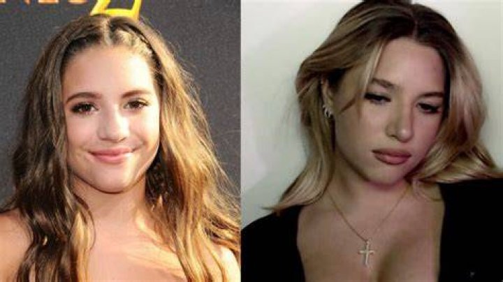 Mackenzie Ziegler Nose Job Botox And Lip: Unveiling The Truth