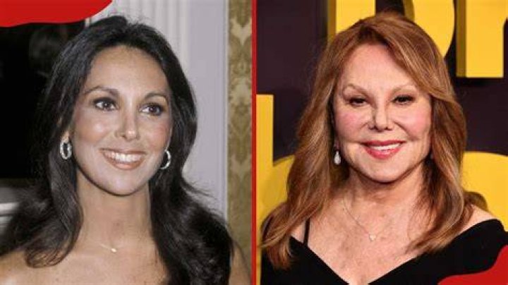 Marlo Thomas Plastic Surgery Before and After Photos Latest Plastic