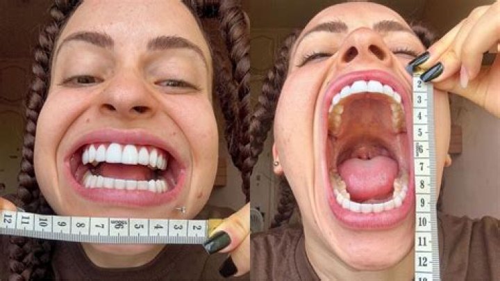 Mulher com a maior boca do mundo revela como ganha R66 mil por post