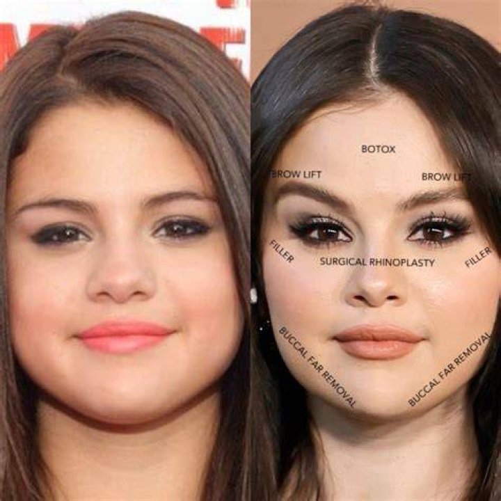 Plastic Surgery Before And After