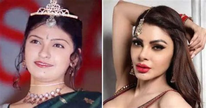Sherlyn Chopra Plastic Surgery Before And After Photos