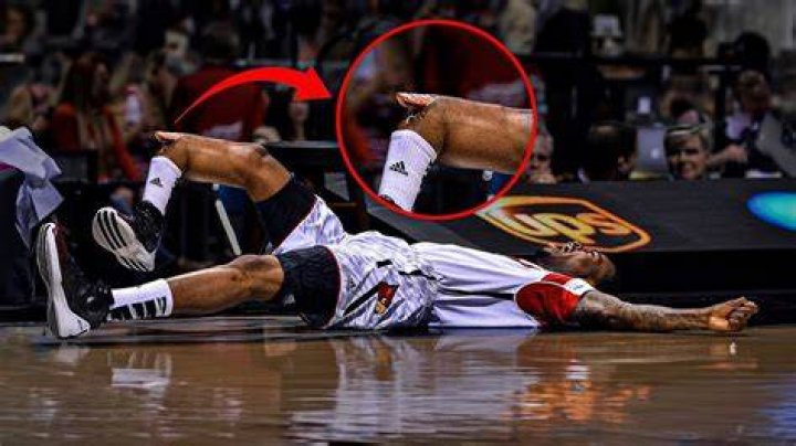 Top 5 Basketball Injuries that Ended These Players' Careers