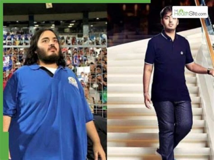 Unveiling Anant Ambani's Weight Loss Secrets: A Journey Of Transformation