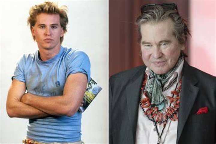 Val Kilmer jokes he laughs 'like a pirate' after undergoing throat