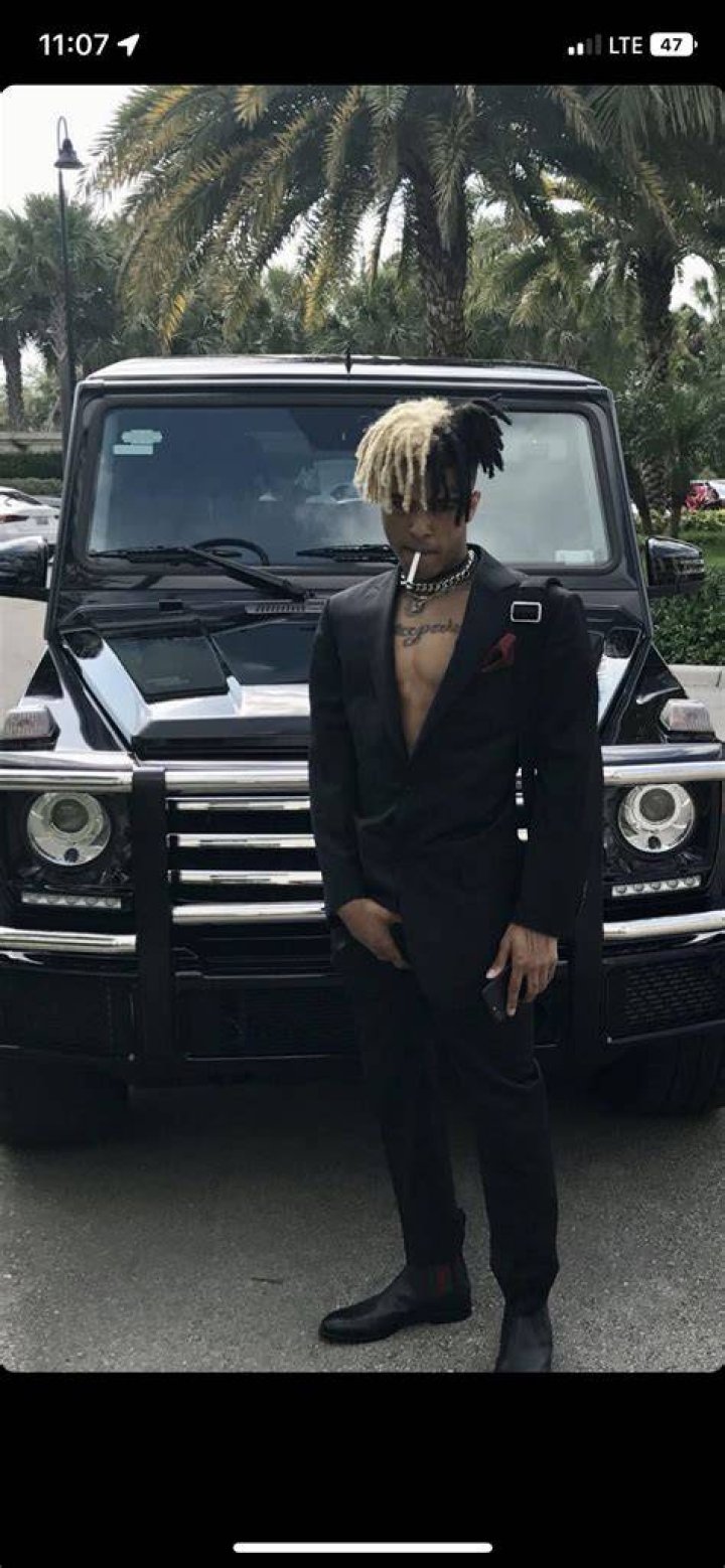 Xxxtentacion autopsy picture, like King Von's, leaked on Reddit and